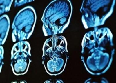 محققان برای تشخیص و درمان بیماری های مغزی محصولی تازه ارائه کردند